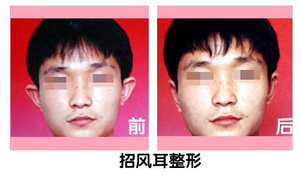 矯正.jpg
