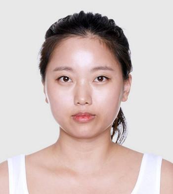 做顴骨縮小.jpg