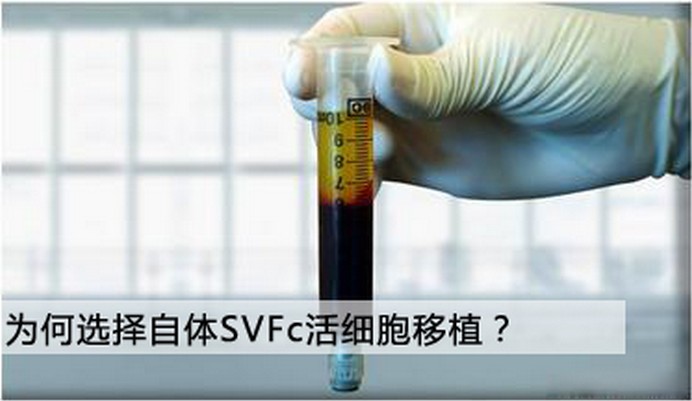 SVFc1.jpg