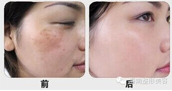 美白.jpg