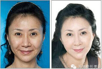 提升膚質(zhì).jpg
