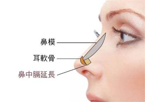 鼻綜合整形.jpg