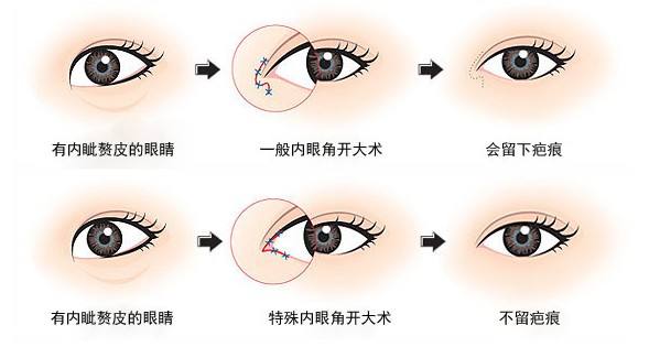 開眼角-林賢超