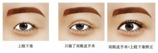 上臉.jpg