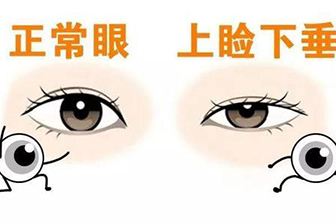 矯正手術(shù).jpg