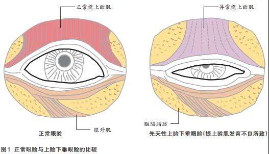 死魚眼.jpg