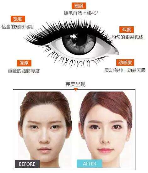 好看雙眼皮.jpg