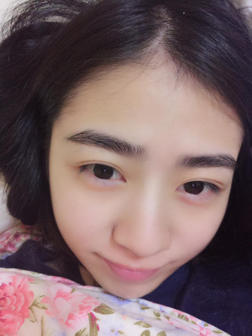 雙眼皮.jpg