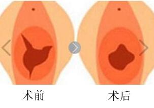 菲蜜麗.jpg